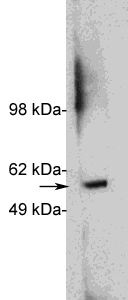  Western blot using Exalpha’s X1879P, rabbit polyclonal at 1 ug/ml on HeLa cell extract (20 ug/lane). Blots were developed with goat anti-rabbit Ig (1:75k) and Pierce’s Supersignal West Femto system.